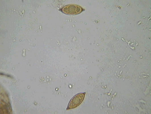 Discina ancilis (Pers.) Sacc. = Discina perlata